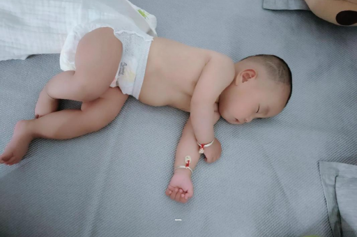 长岭宝宝脸上有白色斑块